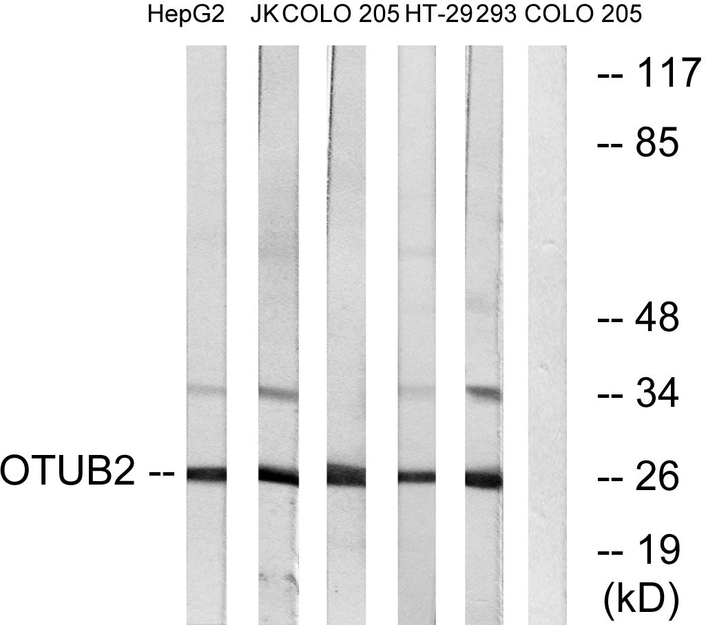 OTUB2 Rabbit Polyclonal Antibody