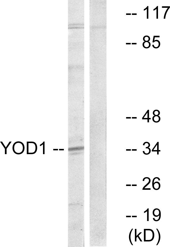 OTUD2 Rabbit Polyclonal Antibody