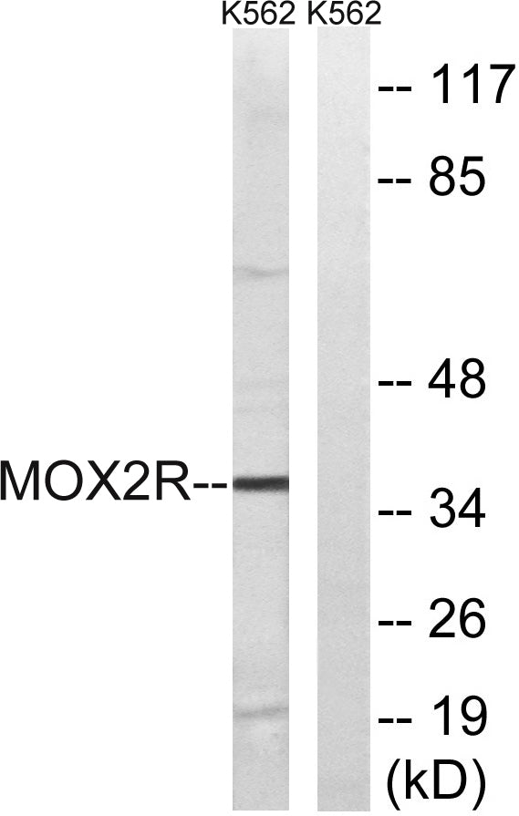 OX2R Rabbit Polyclonal Antibody