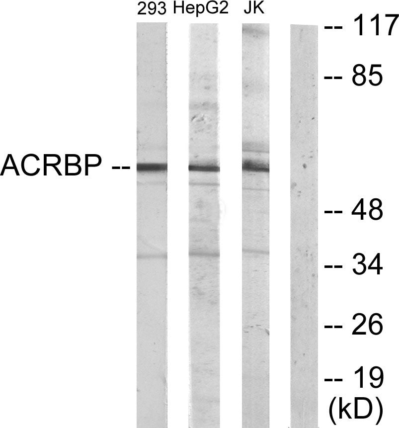 OY-TES-1 Rabbit Polyclonal Antibody