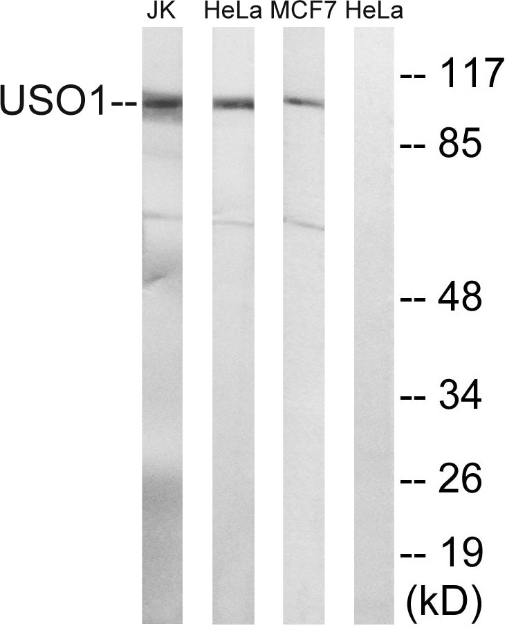 p115 Rabbit Polyclonal Antibody