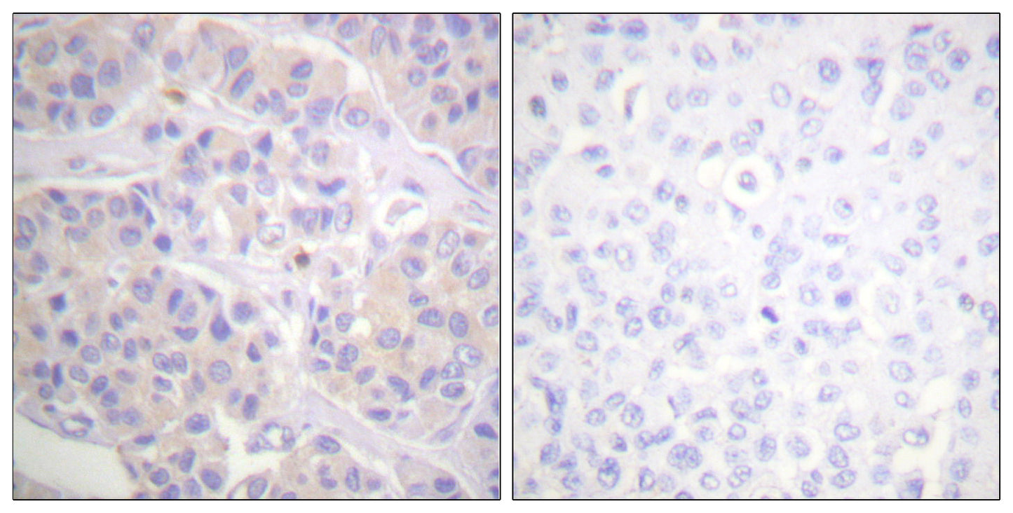p130 Cas Rabbit Polyclonal Antibody