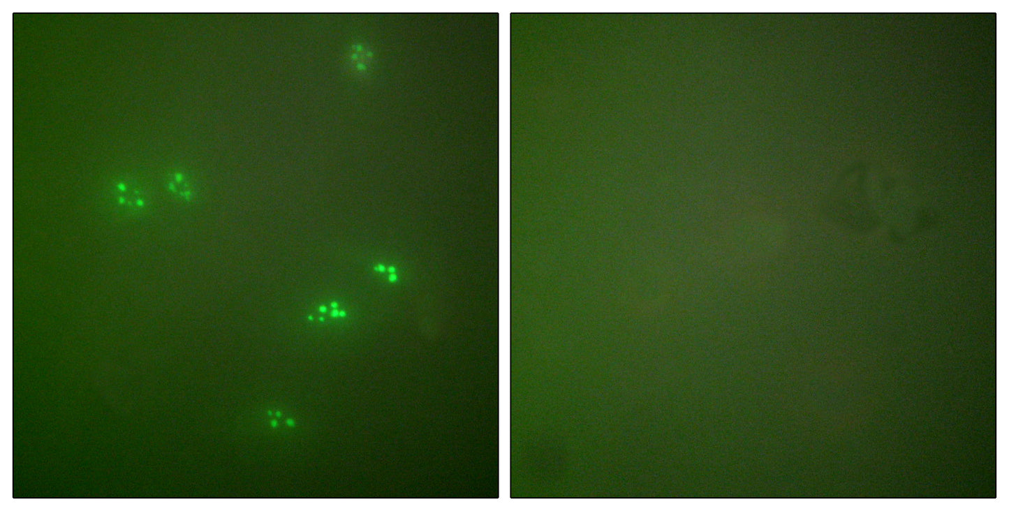 p14 Rabbit Polyclonal Antibody