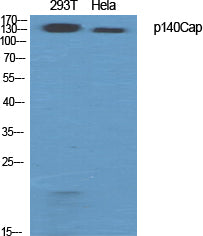p140Cap Rabbit Polyclonal Antibody