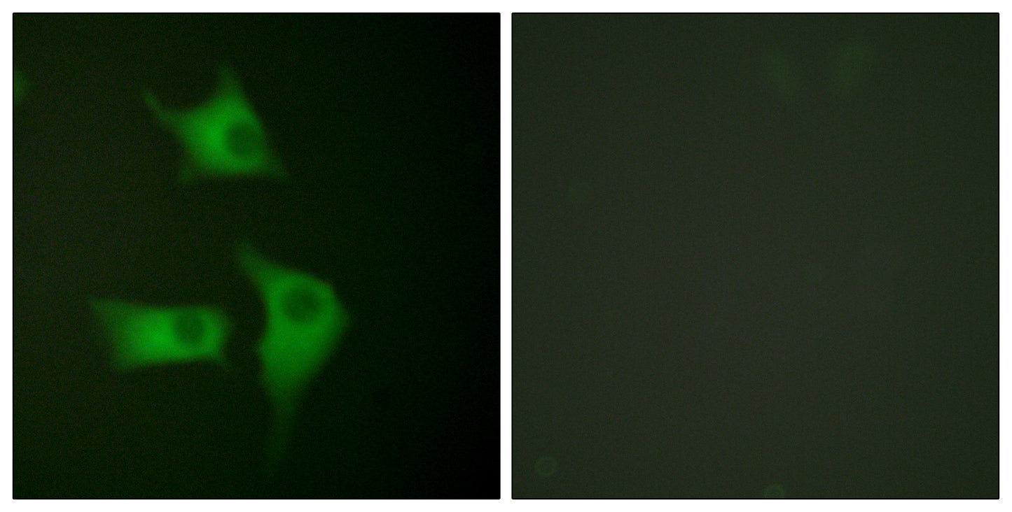 p15 Rabbit Polyclonal Antibody