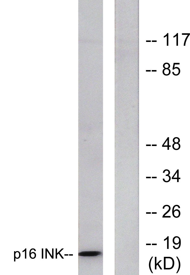 p16 Rabbit Polyclonal Antibody