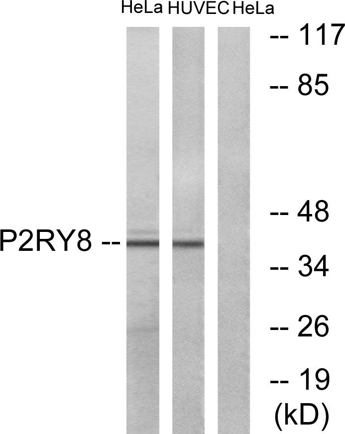 P2RY8 Rabbit Polyclonal Antibody
