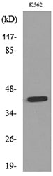 P2X3 Rabbit Polyclonal Antibody
