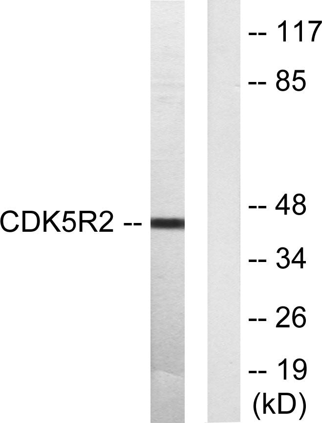 p39 Rabbit Polyclonal Antibody