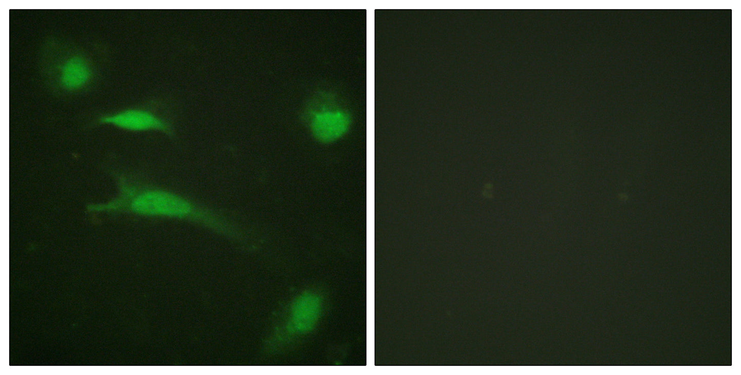 p53 Rabbit Polyclonal Antibody