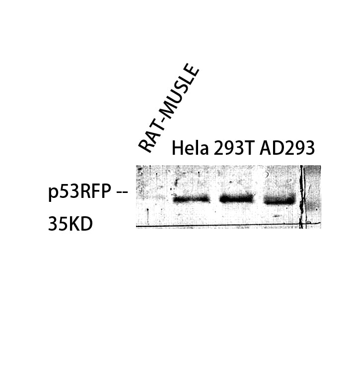 p53RFP Rabbit Polyclonal Antibody