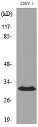 p57 Rabbit Polyclonal Antibody