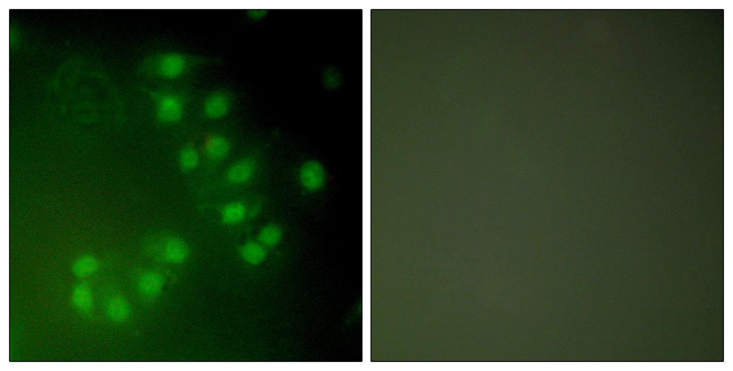 p63 Rabbit Polyclonal Antibody