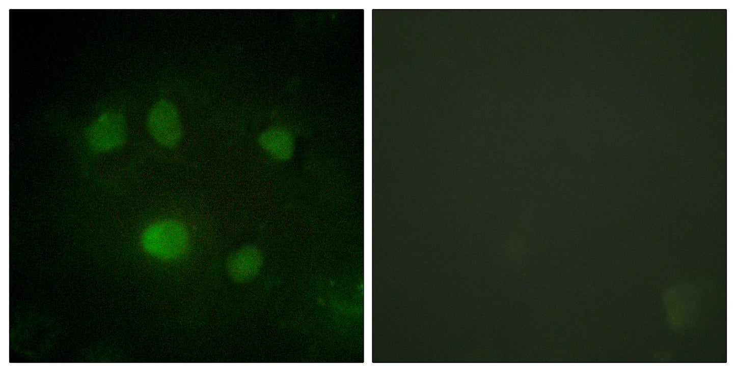 p68 RNA Helicase Rabbit Polyclonal Antibody