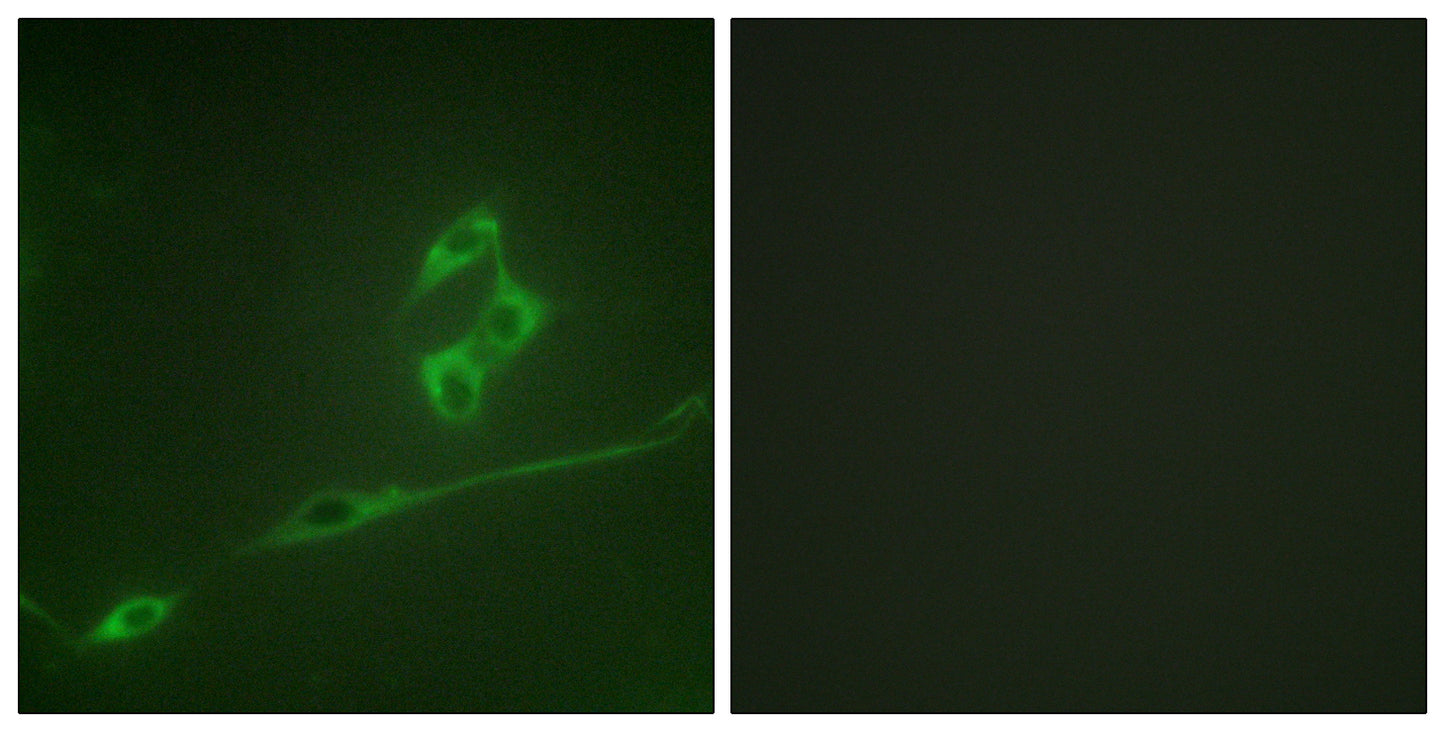 p70 S6 kinase α Rabbit Polyclonal Antibody
