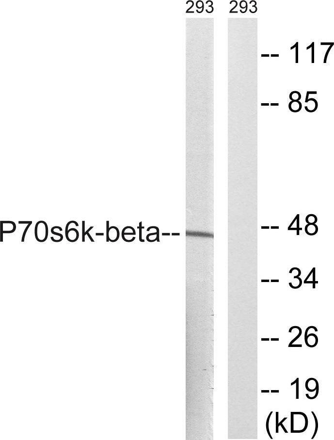 p70 S6 kinase β Rabbit Polyclonal Antibody