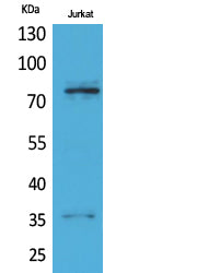 p73 Rabbit Polyclonal Antibody