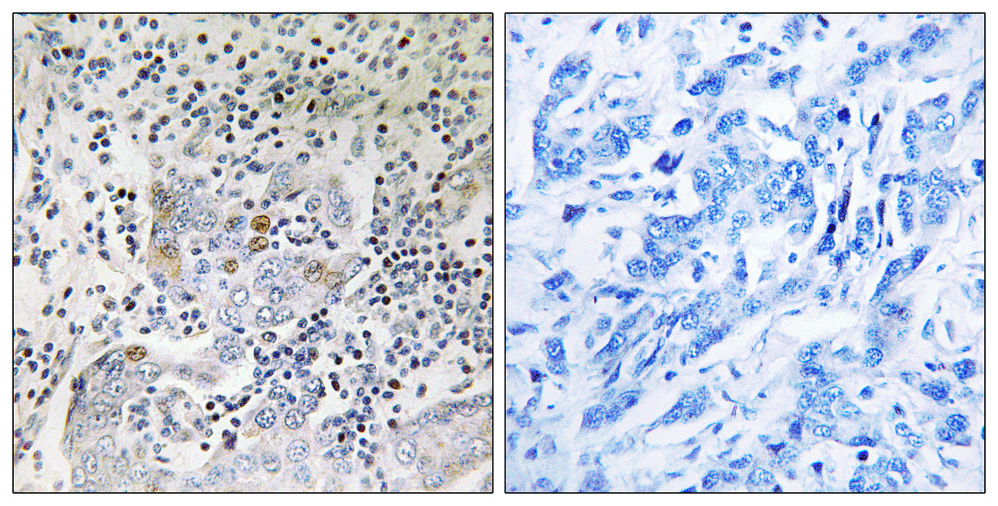 PA26 Rabbit Polyclonal Antibody