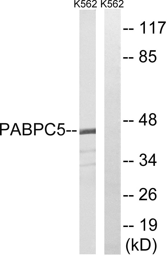 PABP5 Rabbit Polyclonal Antibody