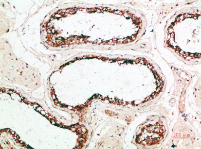 PACAP Rabbit Polyclonal Antibody