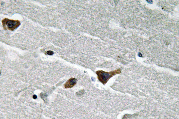 PAI-1 Rabbit Polyclonal Antibody
