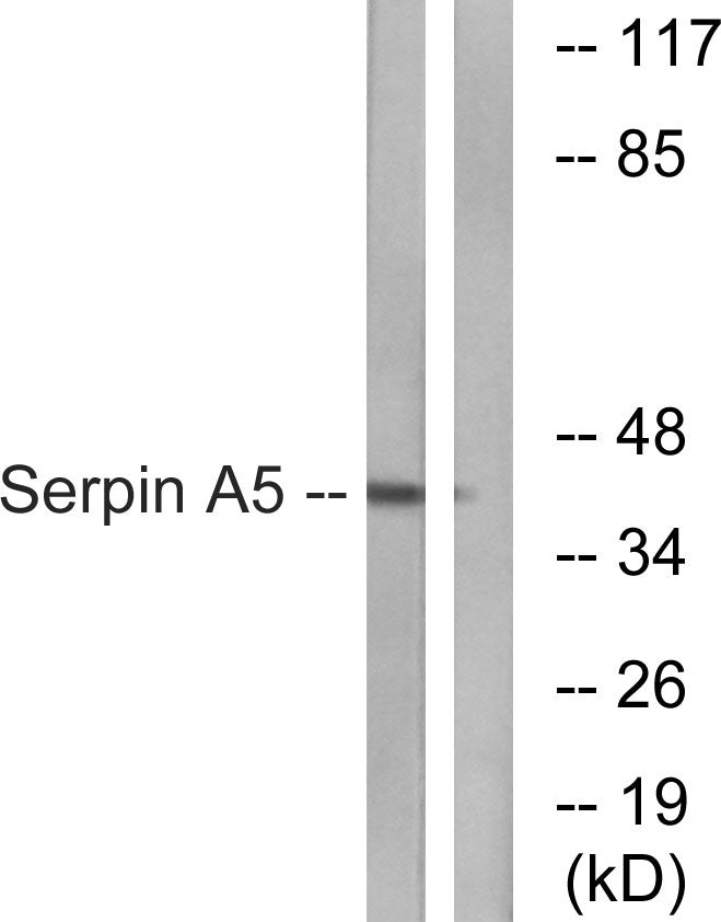 PAI-3 Rabbit Polyclonal Antibody
