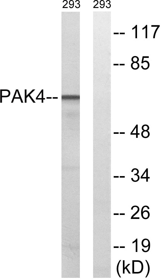 PAK4/5/6 Rabbit Polyclonal Antibody