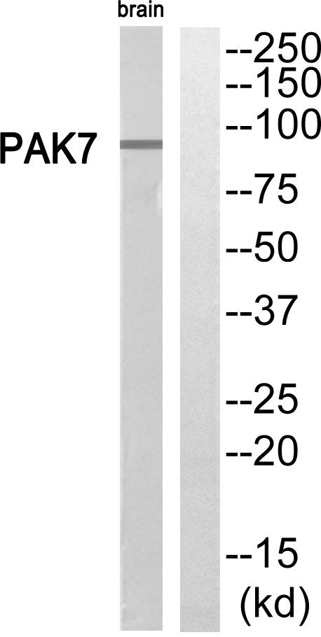 PAK5 Rabbit Polyclonal Antibody