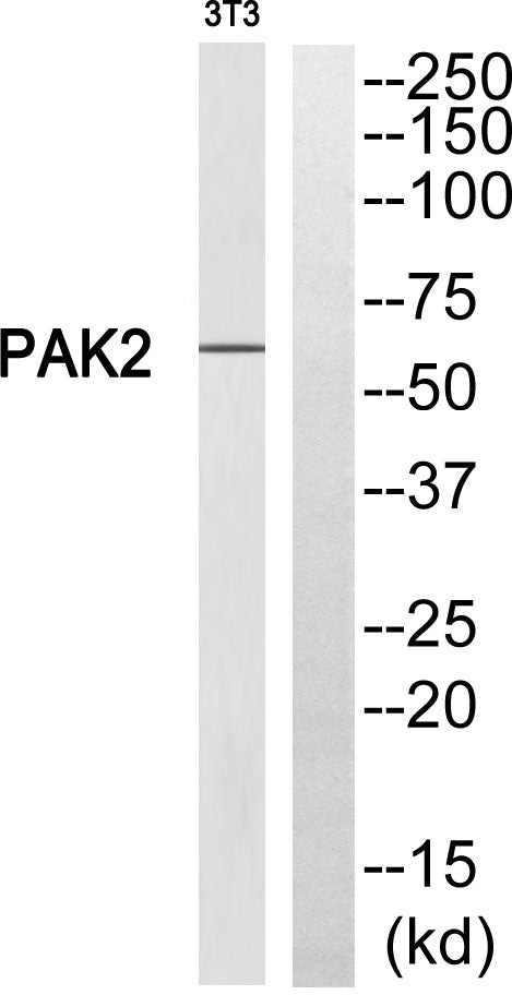 PAKγ Rabbit Polyclonal Antibody