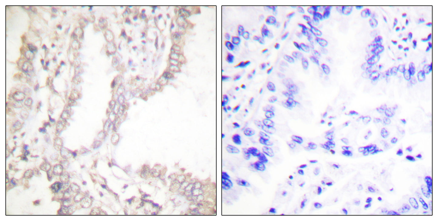 PAR4 Rabbit Polyclonal Antibody