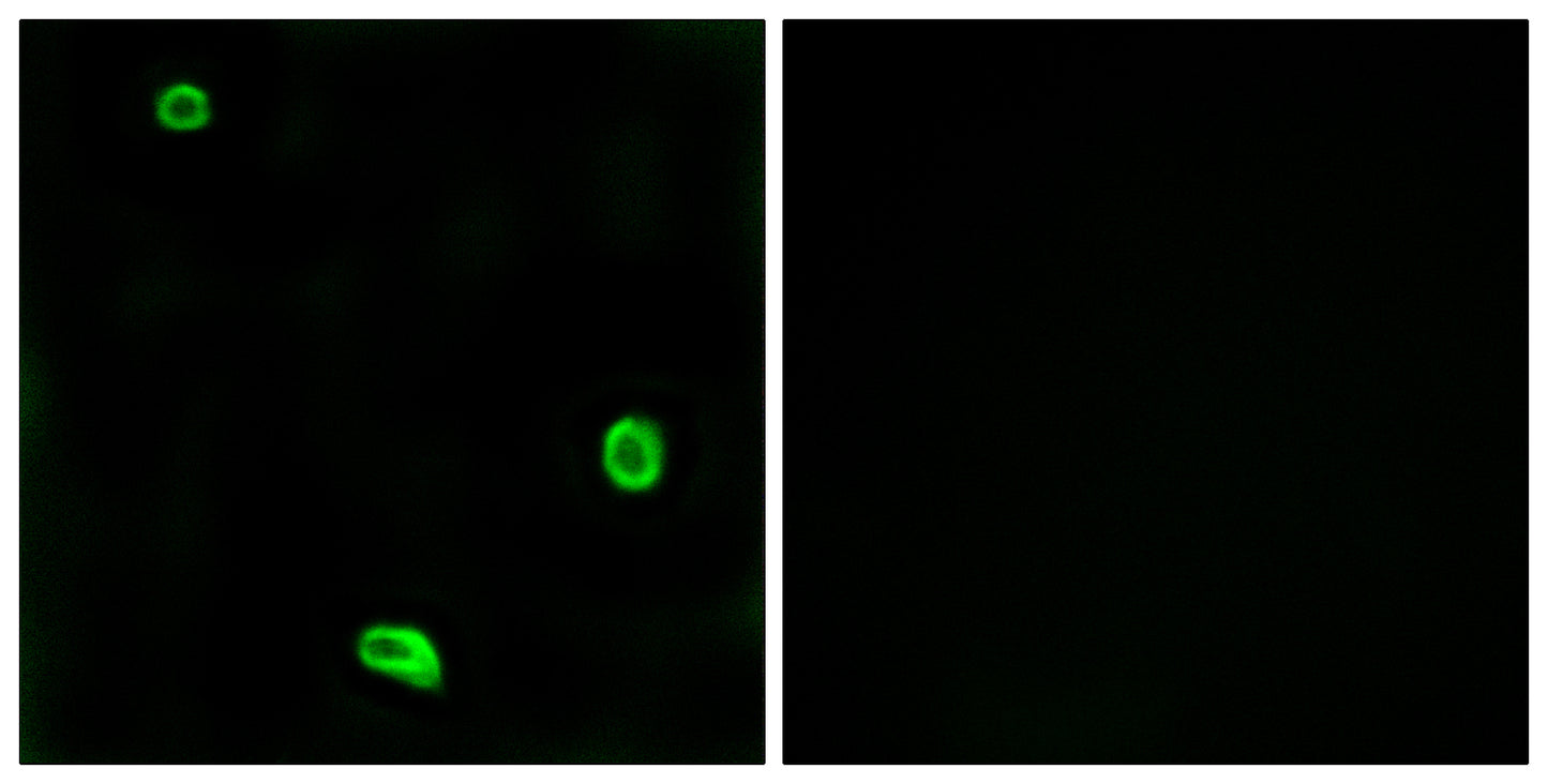 PAR-4 Rabbit Polyclonal Antibody
