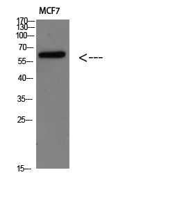 Parathyroid hormone/parathyroid hormone-related peptide receptor Rabbit Polyclonal Antibody
