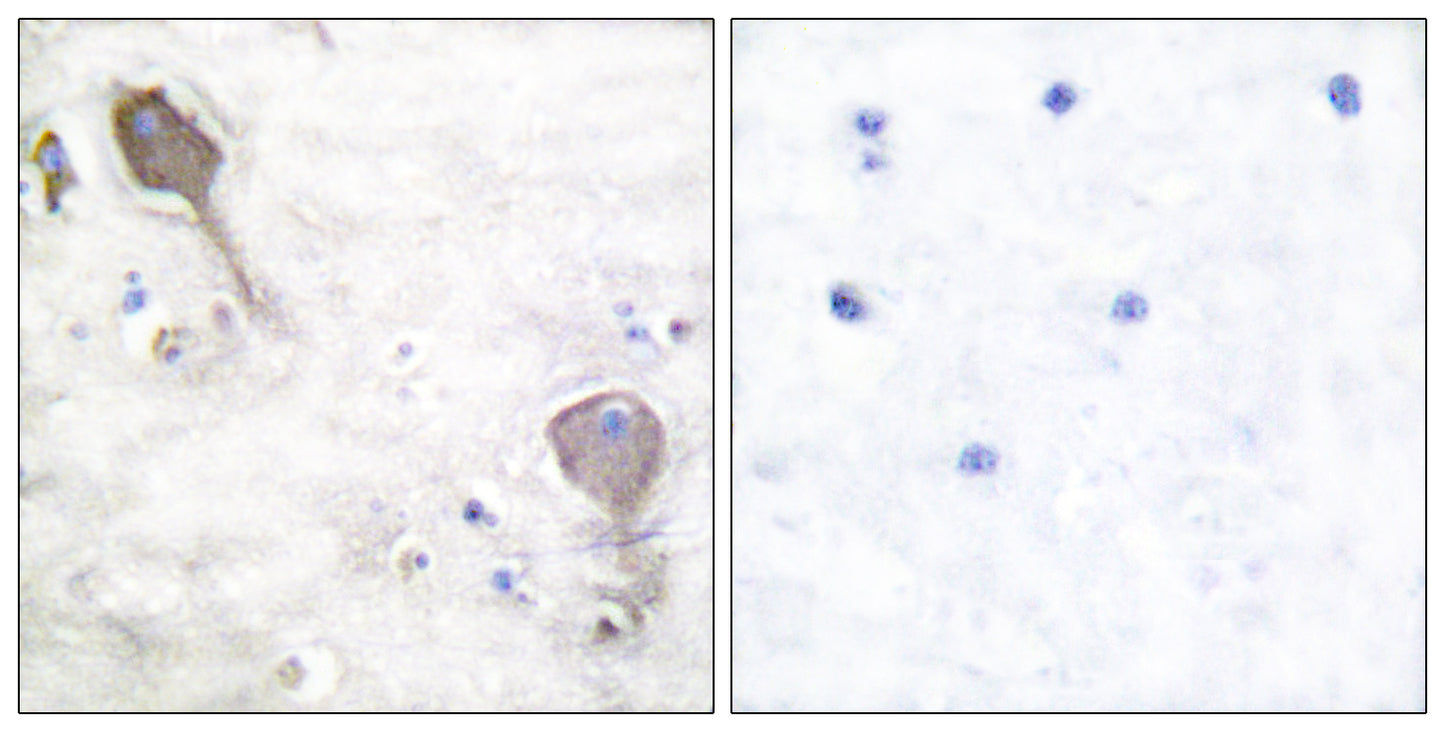 PARK2 Rabbit Polyclonal Antibody