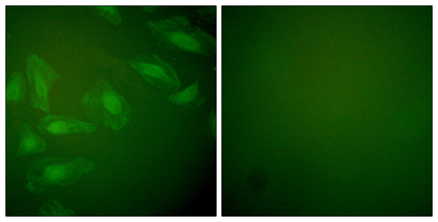 PARK7 Rabbit Polyclonal Antibody