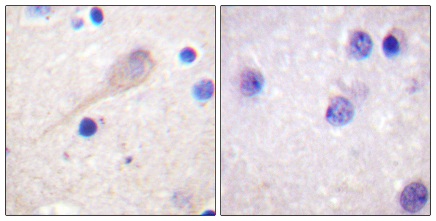 Parkin Rabbit Polyclonal Antibody