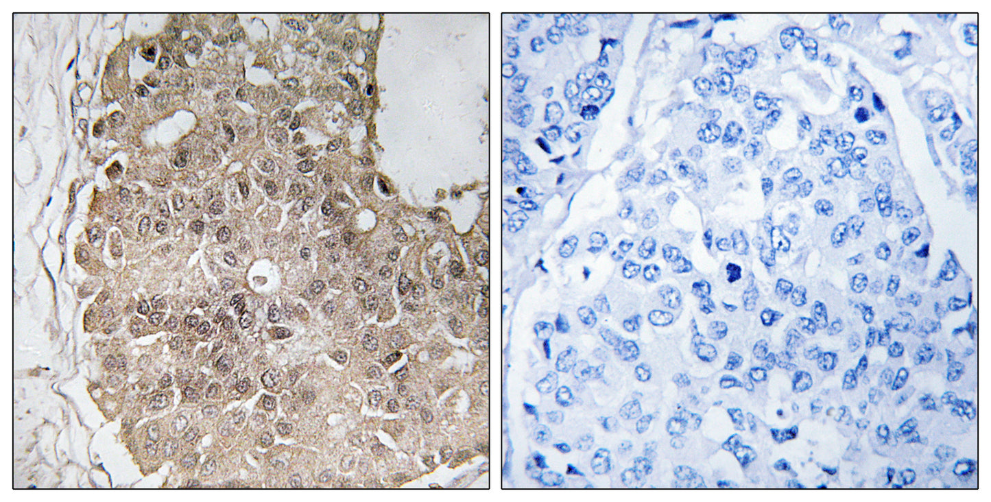 PARP-4 Rabbit Polyclonal Antibody