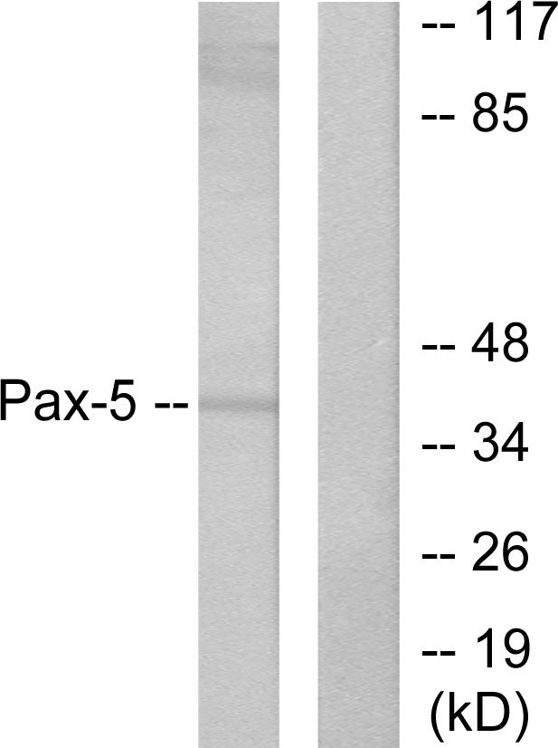 Pax-5 Rabbit Polyclonal Antibody