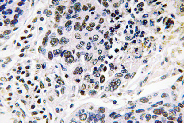Pax-8 Rabbit Polyclonal Antibody