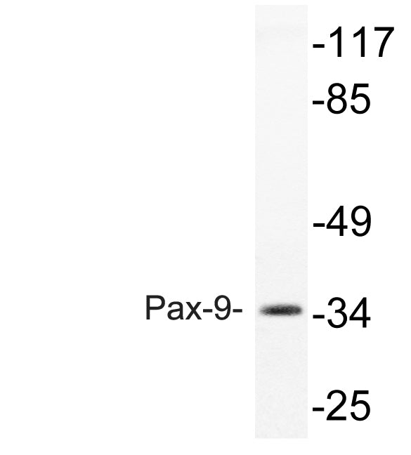 Pax-9 Rabbit Polyclonal Antibody