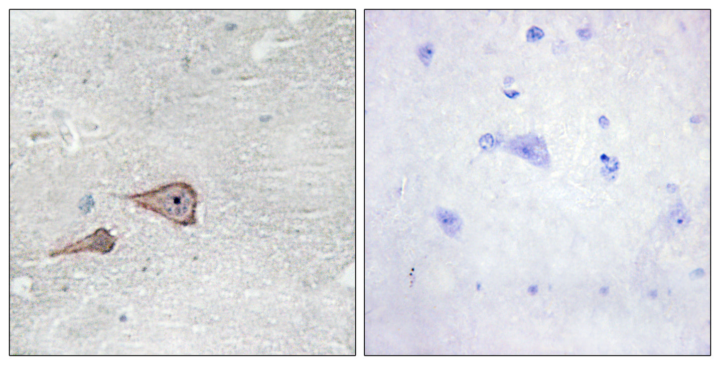 P-cadherin Rabbit Polyclonal Antibody