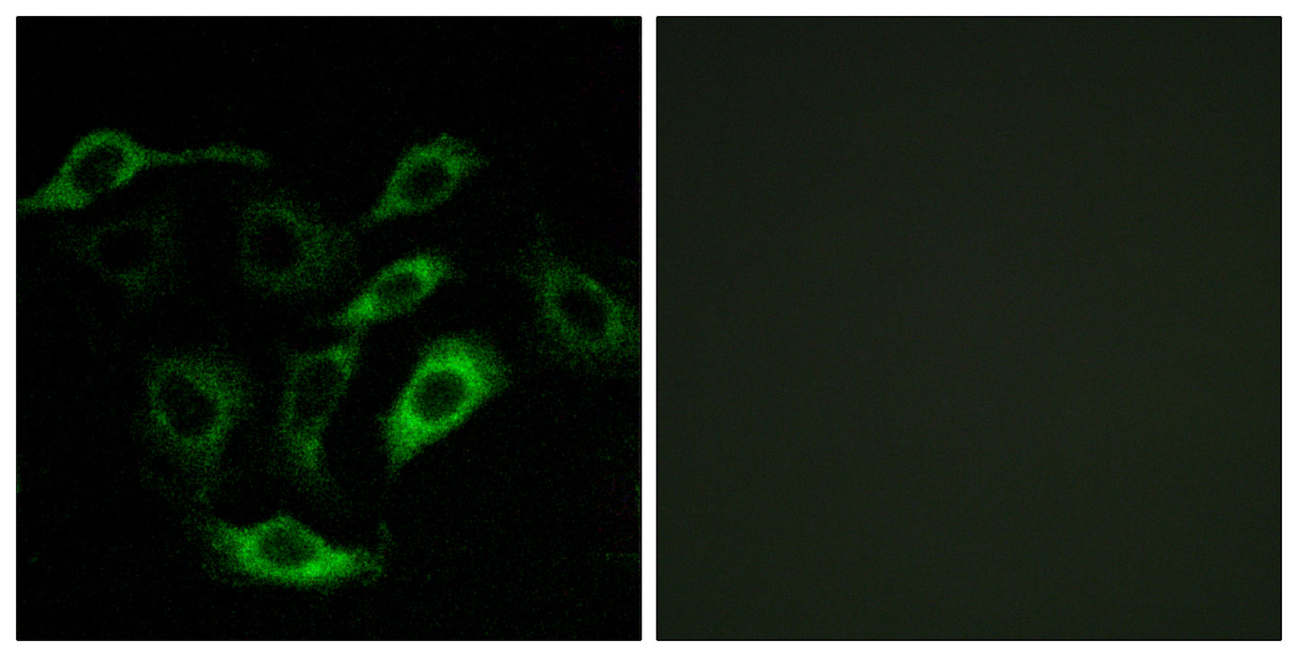 PD2R Rabbit Polyclonal Antibody
