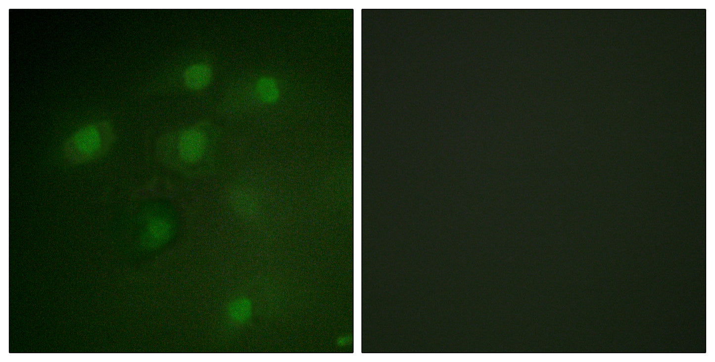 Pdcd-4 Rabbit Polyclonal Antibody