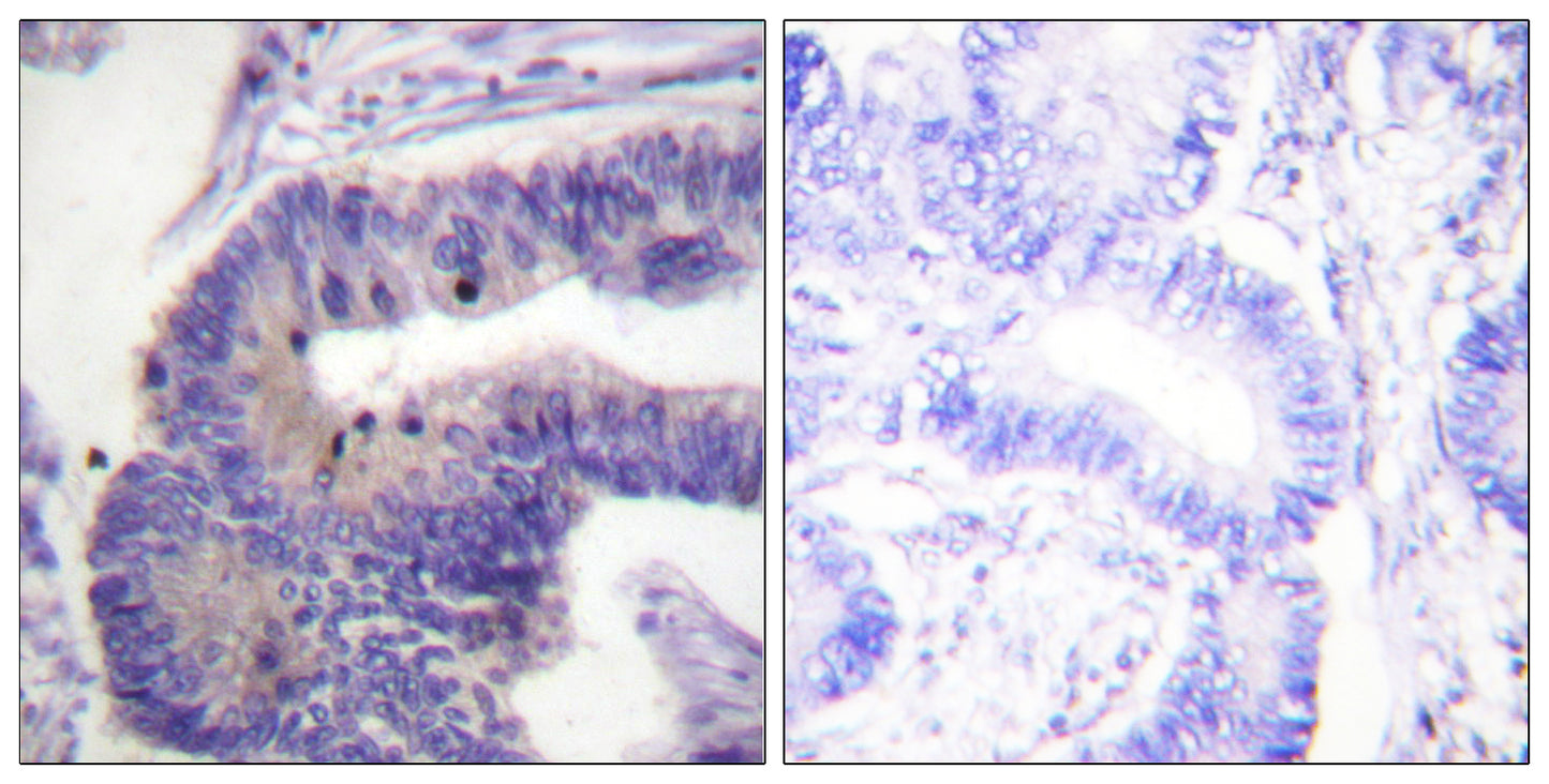 PDE4B/C/D Rabbit Polyclonal Antibody