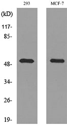 PD-ECGF Rabbit Polyclonal Antibody