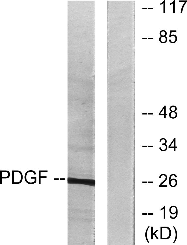 PDGF-B Rabbit Polyclonal Antibody