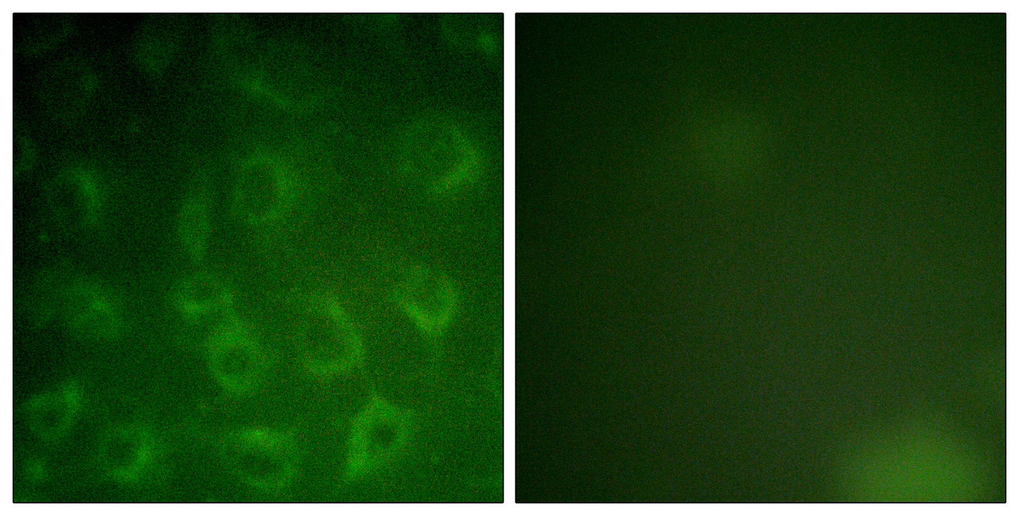PDGFR-β Rabbit Polyclonal Antibody