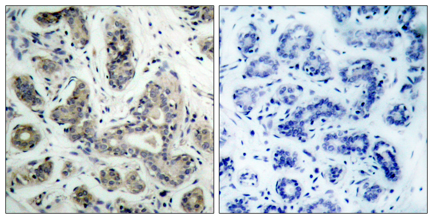 PDK1 Rabbit Polyclonal Antibody