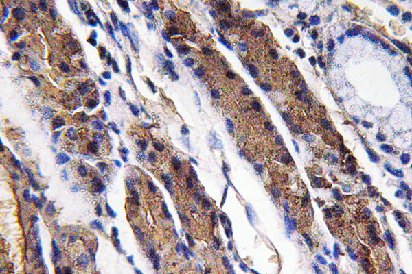 Pepsin A Rabbit Polyclonal Antibody