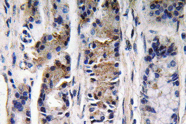 Pepsin C Rabbit Polyclonal Antibody