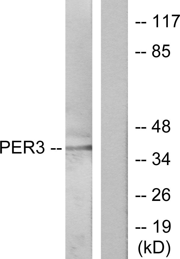 Per3 Rabbit Polyclonal Antibody